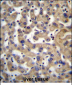 PDP1 Antibody (Center)